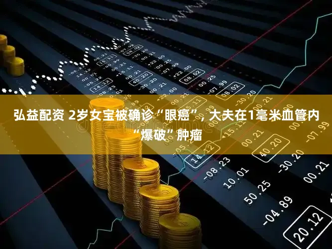 弘益配资 2岁女宝被确诊“眼癌”, 大夫在1毫米血管内“爆破”肿瘤